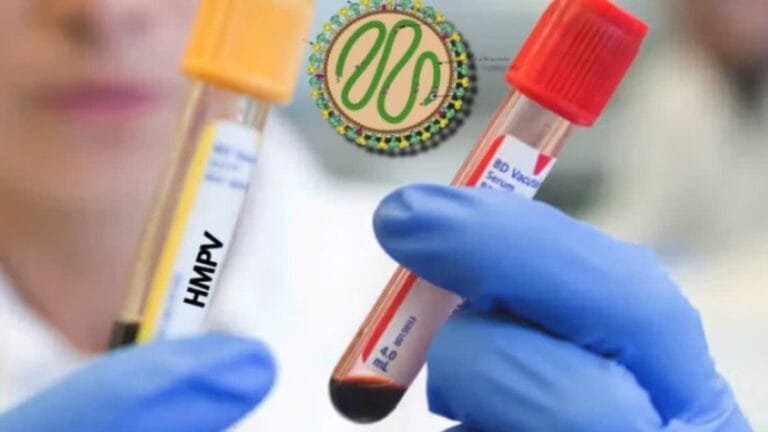 Jaipur SMS अस्पताल में HMVC के दो नए मामले, स्वास्थ्य विभाग सतर्क